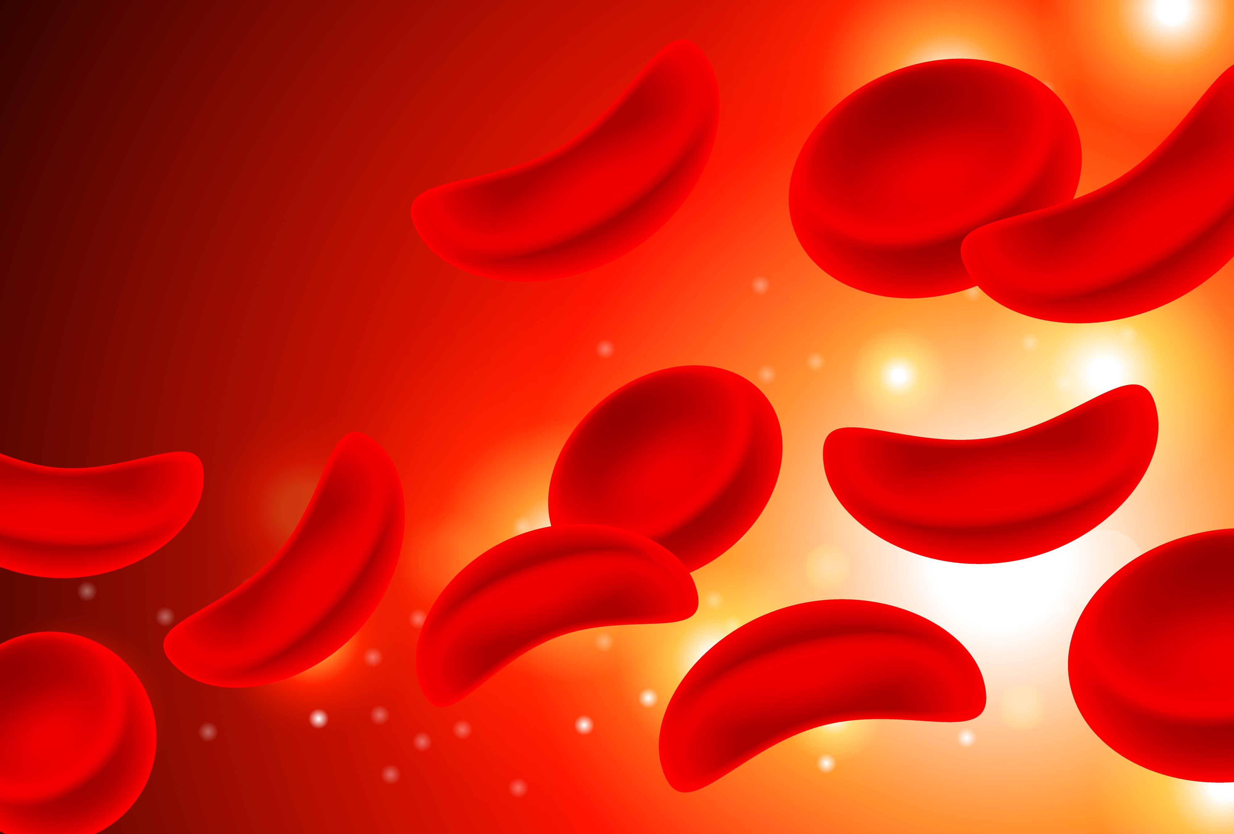 what-is-sickle-cell-anemia-modern-biology-inc