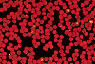 Red.blood.cells_malaria_6884